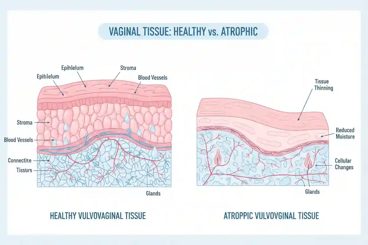 Visual Insights into Atrophic Vulvovaginitis Conditions